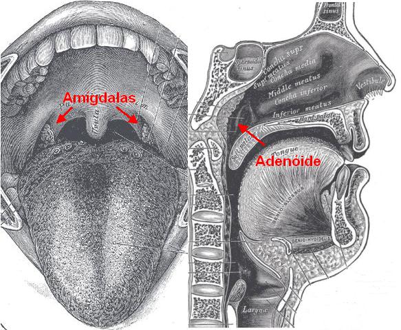 Adenóide e amigdalas
