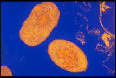 Bordetella pertussis - coqueluche